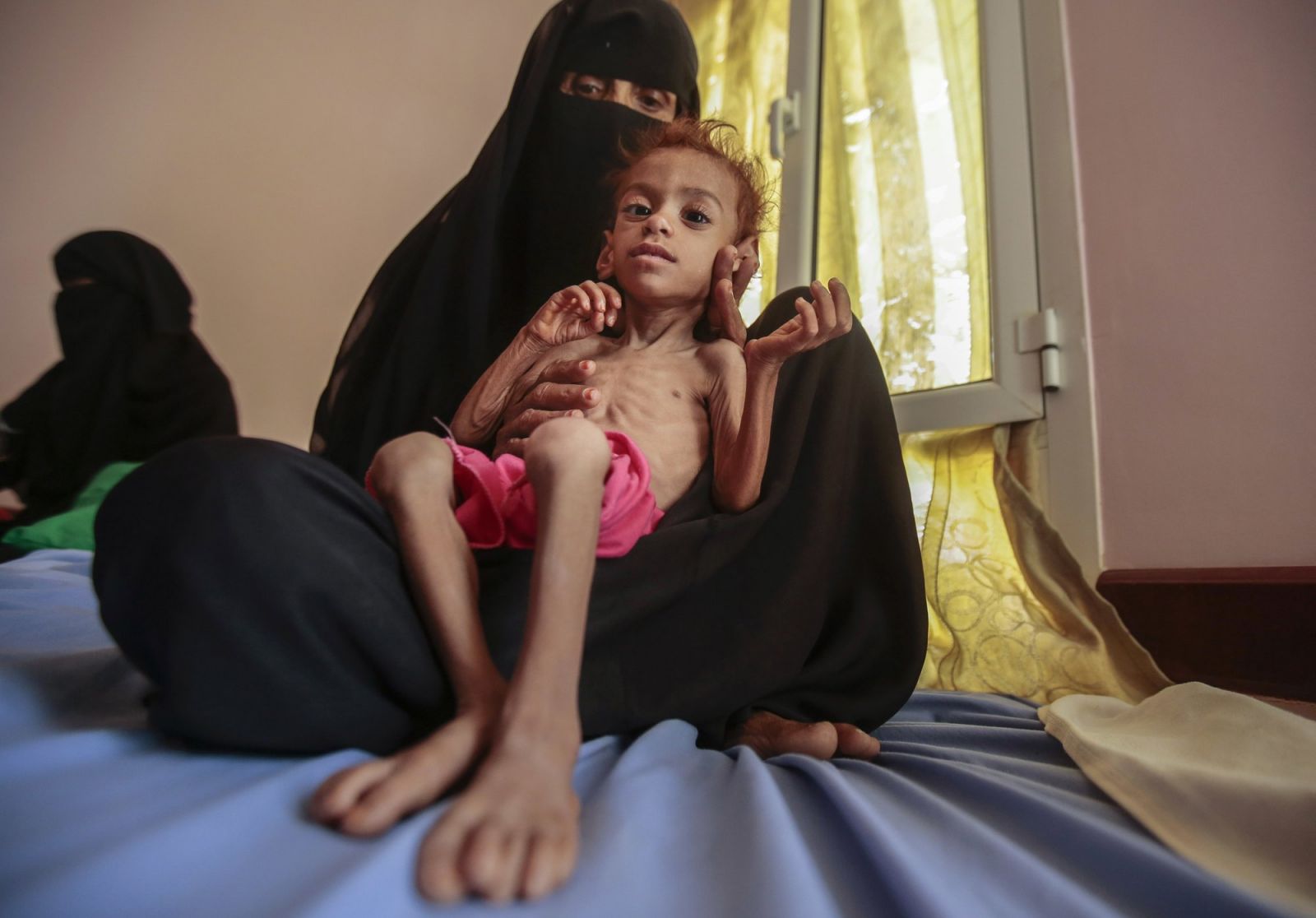 Cơn ác mộng chưa có hồi kết ở Yemen